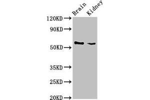 Western Blot Positive WB detected in: Mouse brain tissue, Mouse kidney tissue All lanes: SLC25A23 antibody at 3 μg/mL Secondary Goat polyclonal to rabbit IgG at 1/50000 dilution Predicted band size: 53, 50, 55, 49 kDa Observed band size: 53 kDa (SLC25A23 antibody  (AA 1-188))
