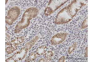 Immunoperoxidase of monoclonal antibody to CDH1 on formalin-fixed paraffin-embedded human stomach. (E-cadherin antibody  (AA 381-480))