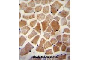 WISP2 Antibody (Center) A immunohistochemistry analysis in formalin fixed and paraffin embedded human skeletal muscle followed by peroxidase conjugation of the secondary antibody and DAB staining.