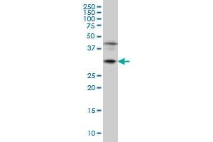 POU6F1 monoclonal antibody (M01), clone 6H1 Western Blot analysis of POU6F1 expression in Jurkat . (POU6F1 antibody  (AA 193-301))