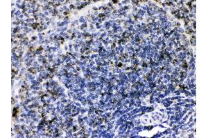 Immunohistochemistry (IHC) image for anti-Complement Component 1, Q Subcomponent Binding Protein (C1QBP) (AA 190-282) antibody (ABIN4886491)