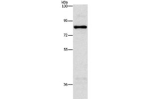 Western Blot analysis of Hela cell using NOL9 Polyclonal Antibody at dilution of 1:1250 (NOL9 antibody)