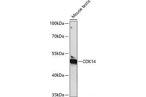 Western blot analysis of extracts of Mouse testis using CDK14 Polyclonal Antibody at dilution of 1:1000. (CDK14 antibody)