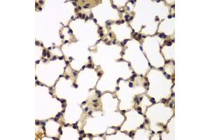 Immunohistochemistry of paraffin-embedded mouse lung using E2F6 antibody (ABIN5973627) at dilution of 1/200 (40x lens). (E2F6 antibody)