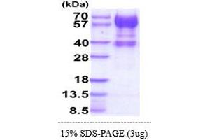 SDS-PAGE (SDS) image for Interleukin 15 Receptor, alpha (IL15RA) (AA 31-205) protein (hIgG-His-tag) (ABIN7529371)