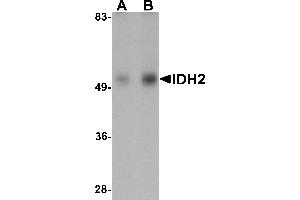 Western Blotting (WB) image for anti-Isocitrate Dehydrogenase 2 (NADP+), Mitochondrial (IDH2) (N-Term) antibody (ABIN1031407) (IDH2 antibody  (N-Term))