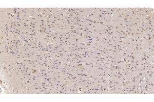 Detection of SIGLEC10 in Human Cerebrum Tissue using Monoclonal Antibody to Sialic Acid Binding Ig Like Lectin 10 (SIGLEC10) (SIGLEC10 antibody  (AA 571-697))