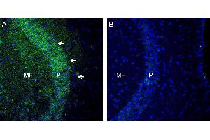 Expression of TSH Receptor in mouse hippocampus. (TSH receptor antibody  (Extracellular, N-Term))