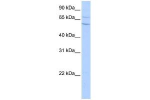 WB Suggested Anti-CPN2 Antibody Titration: 0. (CPN2 antibody  (N-Term))