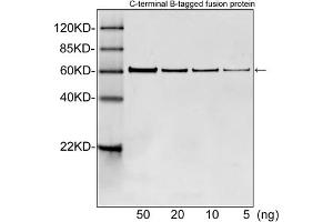 Western blot analysis of B tagged fusion proteins expressed in E.