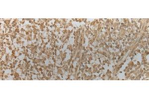 Immunohistochemistry of paraffin-embedded Human tonsil tissue using ZNF8 Polyclonal Antibody at dilution of 1:40(x200) (ZNF8 antibody)