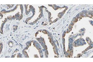 ABIN6277658 at 1/100 staining Human prostate tissue by IHC-P. (TK1 antibody  (N-Term))