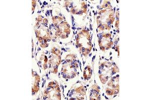 Immunohistochemical analysis of raffin-embedded H. (PACSIN2 antibody  (C-Term))