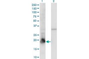 Western Blot analysis of PPIL1 expression in transfected 293T cell line by PPIL1 monoclonal antibody (M01), clone 2C2. (PPIL1 antibody  (AA 76-166))