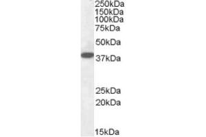 Image no. 1 for anti-Epilepsy, Progressive Myoclonus Type 2A, Lafora Disease (Laforin) (EPM2A) (Internal Region), (Isoform A) antibody (ABIN375087) (EPM2A antibody  (Internal Region, Isoform A))