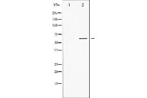 Western blot analysis of Lck phosphorylation expression in Jurkat whole cell lysates,The lane on the left is treated with the antigen-specific peptide. (LCK antibody  (pTyr505))