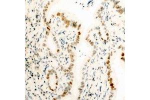 Immunohistochemical analysis of HMGB1 staining in human kidney formalin fixed paraffin embedded tissue section.
