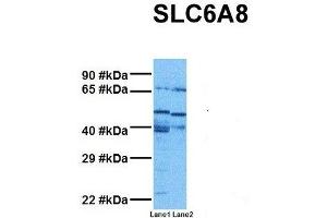 Host:  Rabbit  Target Name:  SLC6A8  Sample Tissue:  Human MDA-MB-435s, Human THP-1  Antibody Dilution:  1. (SLC6A8 antibody  (N-Term))