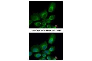 ICC/IF Image Immunofluorescence analysis of paraformaldehyde-fixed A431, using UBE2B, antibody at 1:500 dilution. (UBE2B antibody)