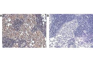 Immunohistochemical staining of human lymphnode tissue using A) anti-IL-33 (human), pAb  and B) anti-rabbit IgG (negative control) . (IL-33 antibody)