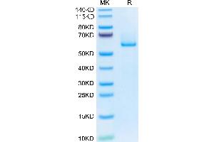 FBLN3 Protein (AA 18-493) (His tag)