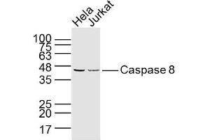 Lane 1: hela lysates Lane 2: jurkat lysates probed with Caspase 8 Monoclonal Polyclonal Antibody, Unconjugated  at 1:300 dilution and 4˚C overnight incubation. (Caspase 8 antibody)