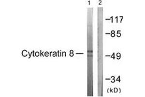 Western blot analysis of extracts from 293 cells, treated with EGF 200ng/ml 30', using Keratin 8 (Ab-431) Antibody. (KRT8 antibody  (AA 401-450))