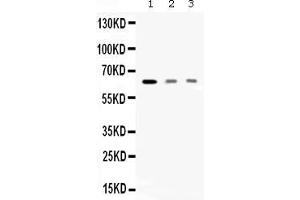 Western blot analysis of AMHR2 expression in rat skeletal muscle extract ( Lane 1), HELA whole cell lysates ( Lane 2) and MCF-7 whole cell lysates ( Lane 3). (AMHR2 antibody  (C-Term))