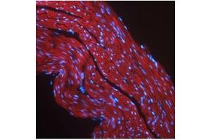 Immunofluorescent IGF1R detection in mouse skeletal muscle (red fluorescence).