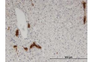 Immunoperoxidase of monoclonal antibody to CAPN9 on formalin-fixed paraffin-embedded human liver. (Calpain 9 antibody  (AA 591-690))