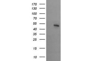 Image no. 3 for anti-serine/threonine Kinase 38 Like (STK38L) (AA 1-281) antibody (ABIN1490700) (STK38L antibody  (AA 1-281))