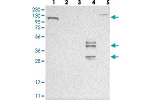 Western blot analysis of Lane 1: RT-4, Lane 2: U-251 MG, Lane 3: Human Plasma, Lane 4: Liver, Lane 5: Tonsil with ESPN polyclonal antibody .