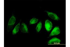 Immunofluorescence of purified MaxPab antibody to ALDH3A2 on HeLa cell. (ALDH3A2 antibody  (AA 1-508))