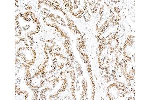 Immunohistochemistry (IHC) image for anti-Lamin B1 (LMNB1) (AA 450-500) antibody (ABIN7795809)