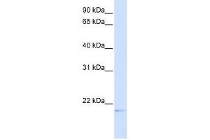 C14ORF180 antibody used at 1 ug/ml to detect target protein. (C14orf180 antibody  (Middle Region))