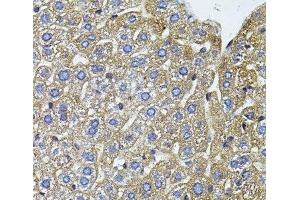 Immunohistochemistry of paraffin-embedded Mouse liver using CETP Polyclonal Antibody (CETP antibody)