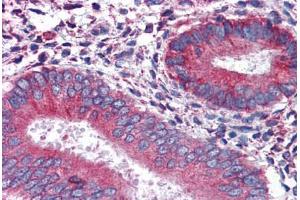 Human Uterus: Formalin-Fixed, Paraffin-Embedded (FFPE) (Calnexin antibody  (AA 204-218))