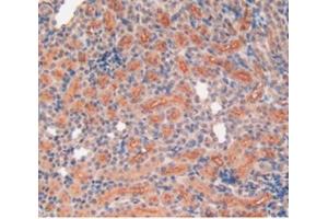 Detection of MMP12 in Rat Kidney Tissue using Polyclonal Antibody to Matrix Metalloproteinase 12 (MMP12) (MMP12 antibody  (AA 20-99))