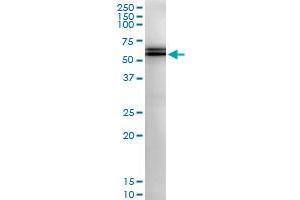 Immunoprecipitation of PCCB transfected lysate using anti-PCCB MaxPab rabbit polyclonal antibody and Protein A Magnetic Bead , and immunoblotted with PCCB purified MaxPab mouse polyclonal antibody (B01P) . (PCCB antibody  (AA 1-539))