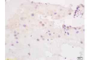 Formalin-fixed and paraffin embedded human placenta labeled with Anti SLC40A1/FPN1 Polyclonal Antibody, Unconjugated (ABIN1387819) at 1:200 followed by conjugation to the secondary antibody and DAB staining