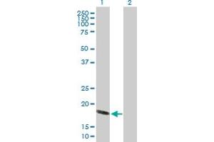 Western Blot analysis of HSPB6 expression in transfected 293T cell line by HSPB6 MaxPab polyclonal antibody. (HSPB6 antibody  (AA 1-160))