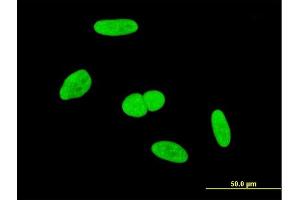 Immunofluorescence of monoclonal antibody to INTS6 on HeLa cell. (INTS6 antibody  (AA 779-887))