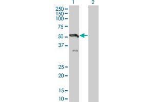 Western Blot analysis of MAP2K7 expression in transfected 293T cell line by MAP2K7 monoclonal antibody (M07), clone 2C12. (MAP2K7 antibody  (AA 1-99))