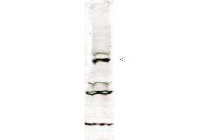 Western blot using anti-Tlk-1 antibody shows detection of a band ~64 kDa corresponding to isoform 3 of human Tlk-1 (arrowhead). (TLK1 antibody  (Isoform 1, pSer695))