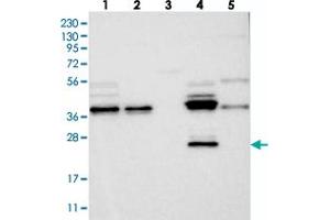Western blot analysis of Lane 1: RT-4, Lane 2: U-251 MG, Lane 3: Human Plasma, Lane 4: Liver, Lane 5: Tonsil with ZFAND6 polyclonal antibody  at 1:250-1:500 dilution. (ZFAND6 antibody)
