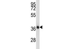 NKX2. (NK2 Homeobox 4 antibody  (AA 2-4))