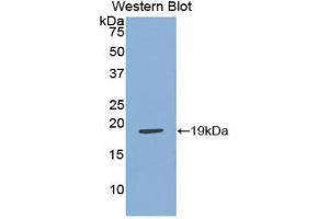 Western Blotting (WB) image for anti-Adrenomedullin (ADM) (AA 31-187) antibody (ABIN1172572)