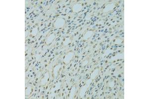 Immunohistochemistry of paraffin-embedded mouse kidney using SAFB antibody.