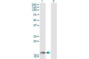 Western Blot analysis of UBE2L6 expression in transfected 293T cell line by UBE2L6 monoclonal antibody (M01), clone 2F12-1F4. (UBE2L6 antibody  (AA 1-153))
