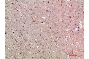 Immunohistochemical analysis of paraffin-embedded human-brain, antibody was diluted at 1:200 (ASCL1 antibody  (AA 190-236))